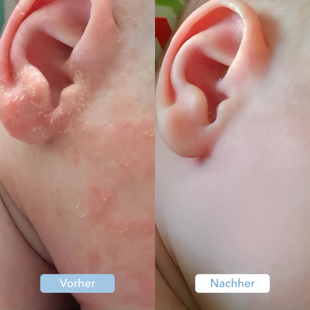 Baby Wasserfilter (1+1 Gratis)