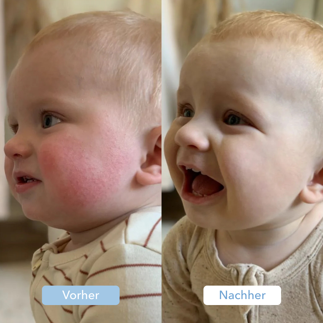 Baby Wasserfilter (1+1 Gratis)